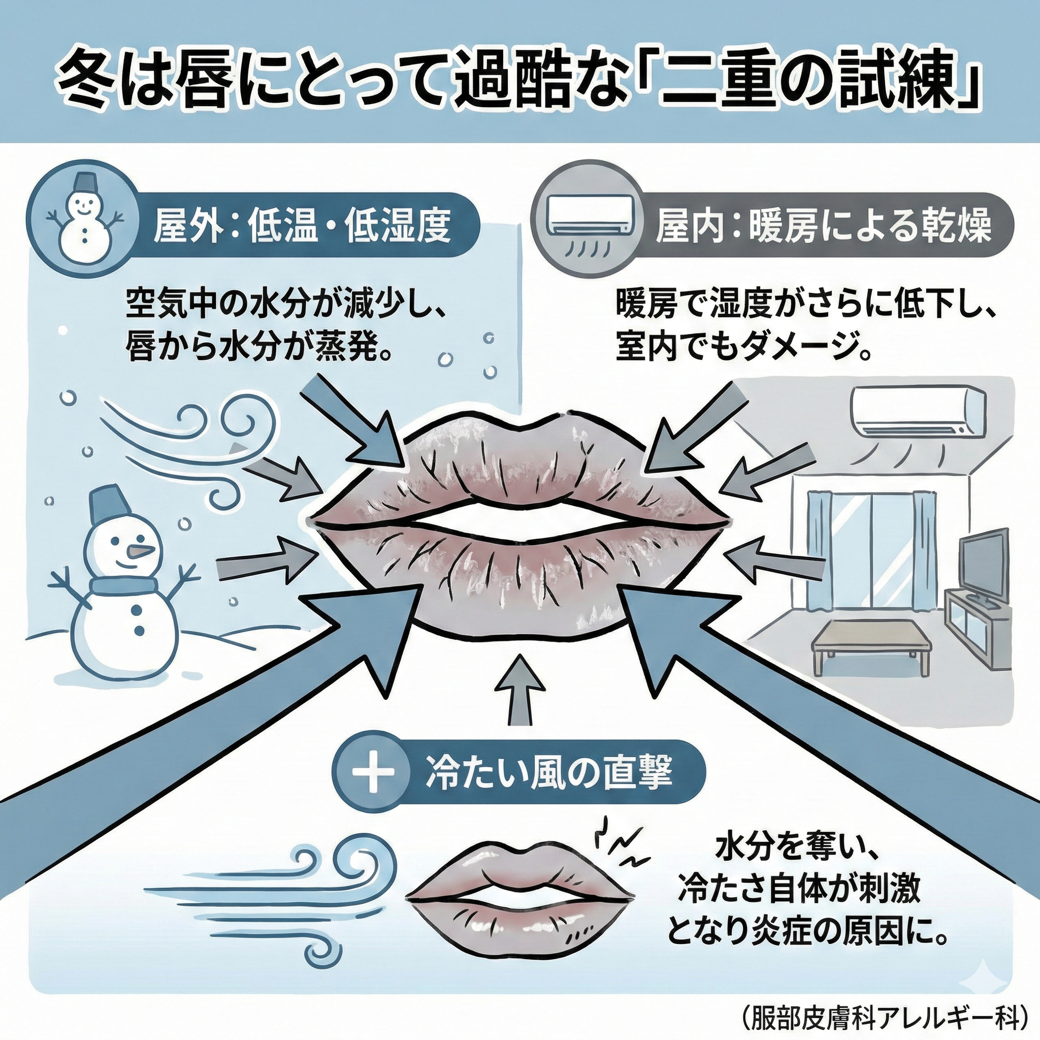 冬は唇に過酷な季節