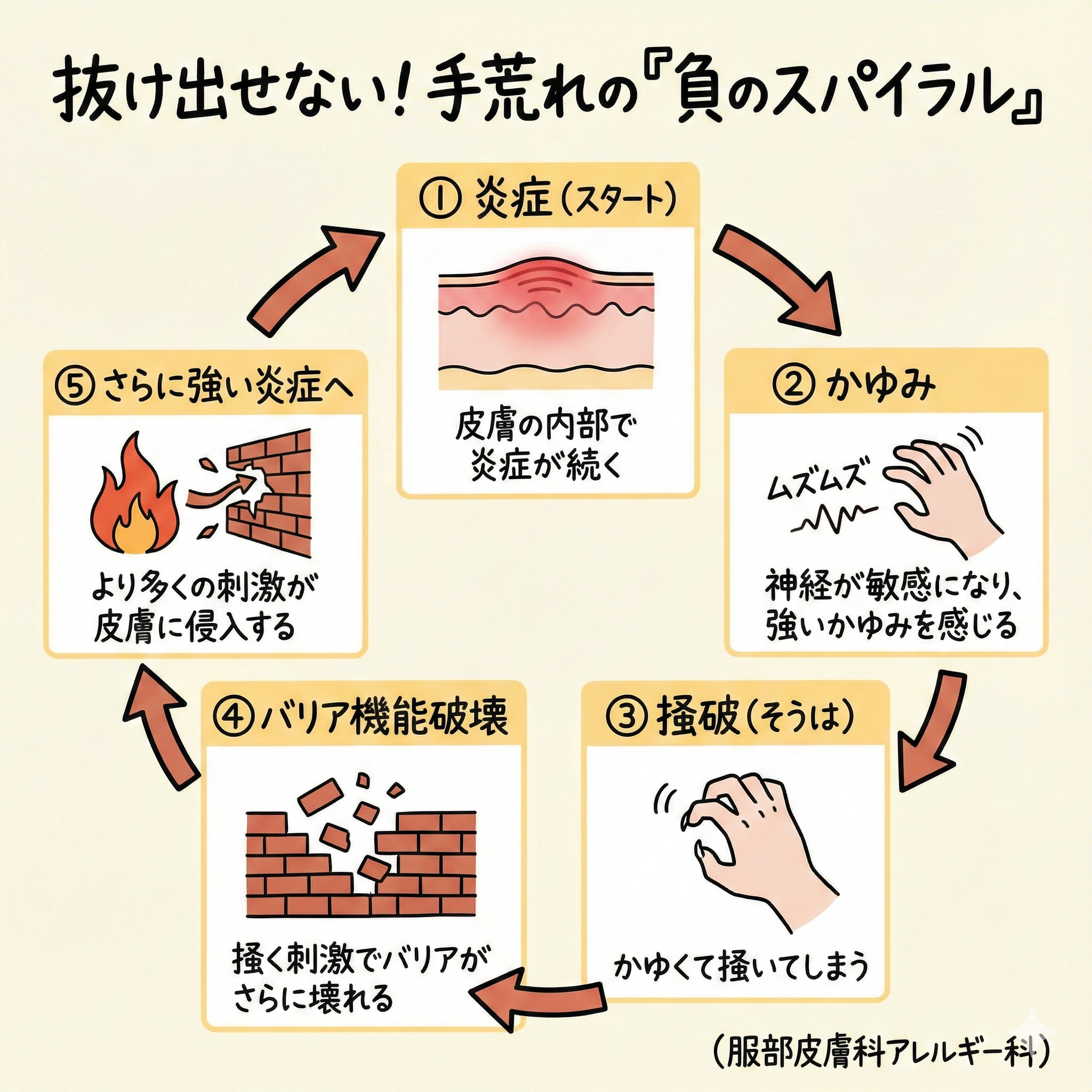手荒れの悪循環