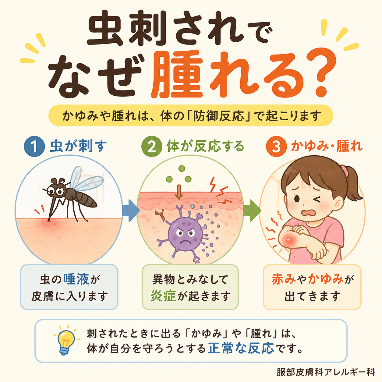 なぜ腫れる？