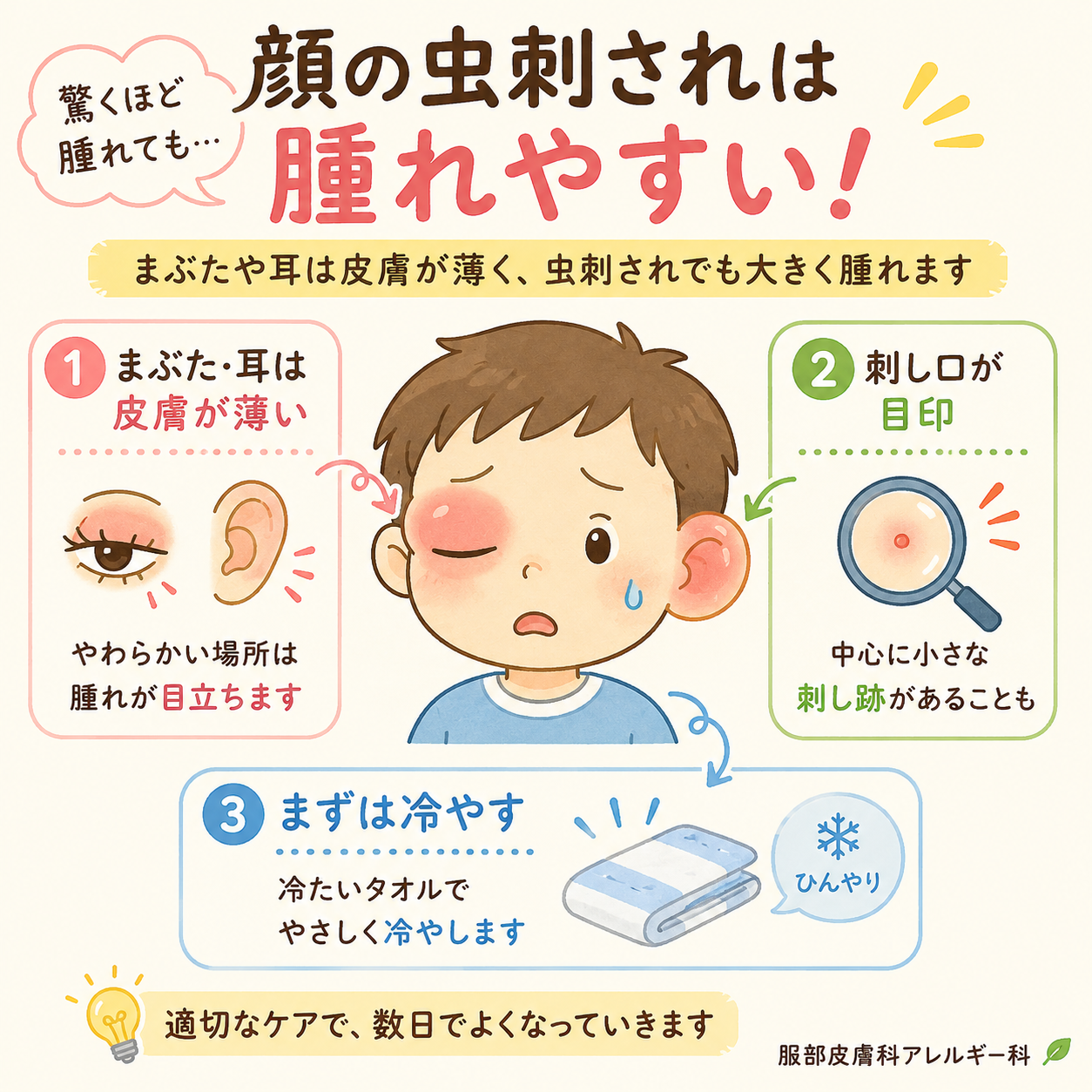 顔の虫刺されは腫れやすい