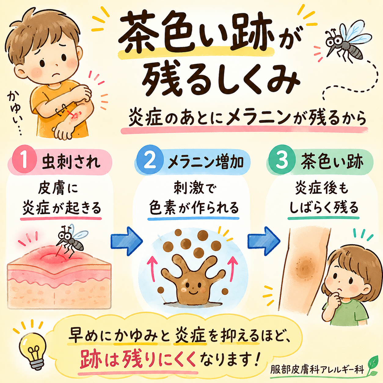 跡が残る仕組み