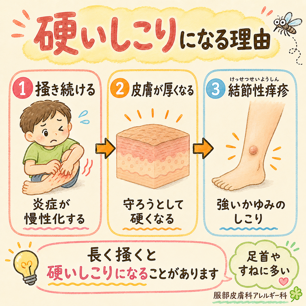 硬いしこりになる理由