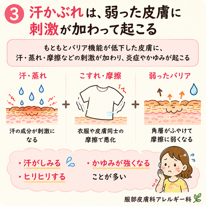 汗かぶれ