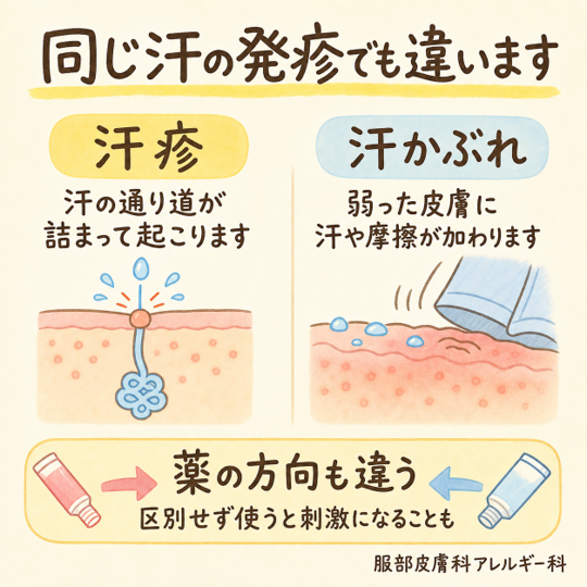 汗の発疹でも違う