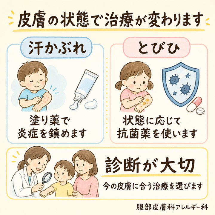 皮膚の状態で治療が変わる