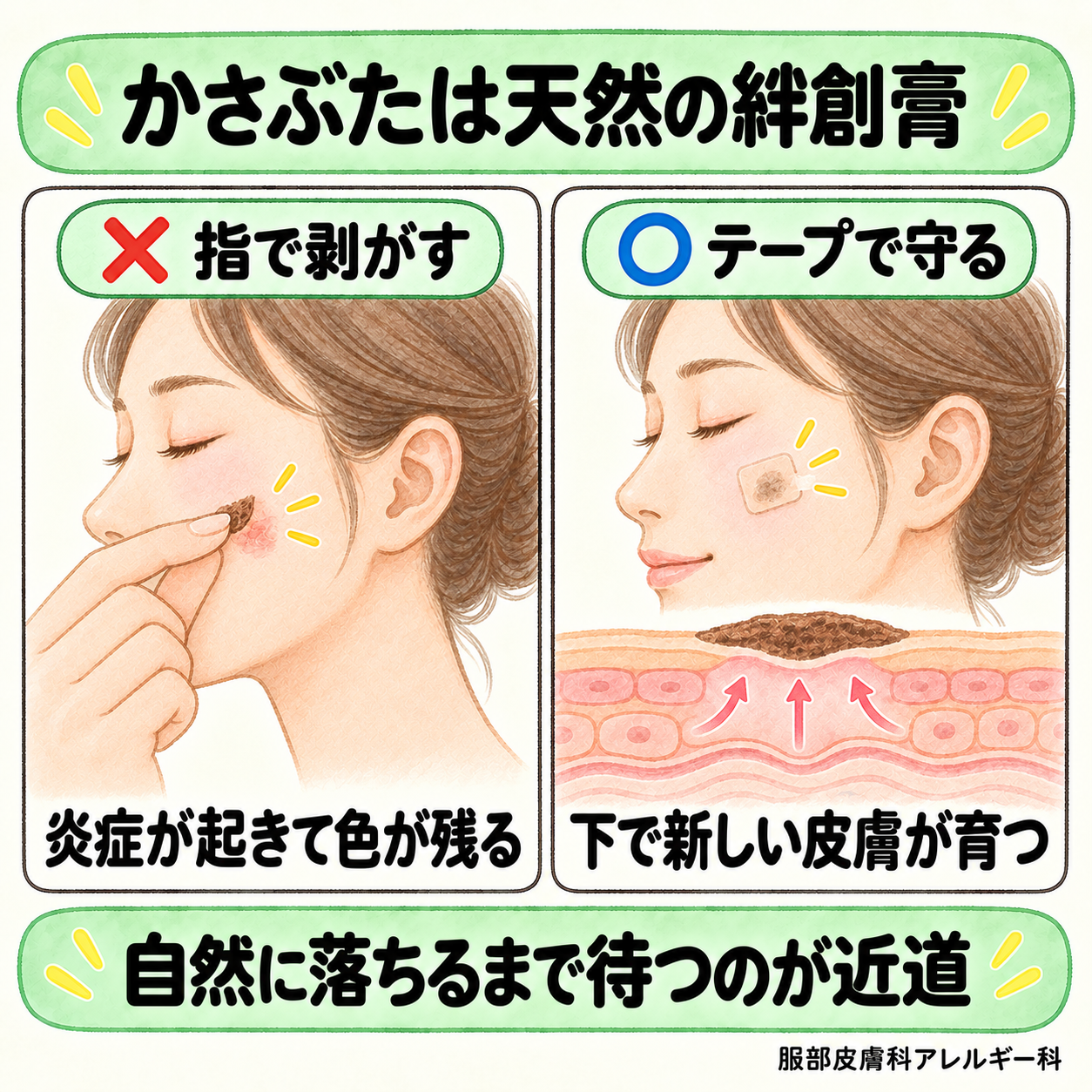 かさぶたは剥がさずテープで守る