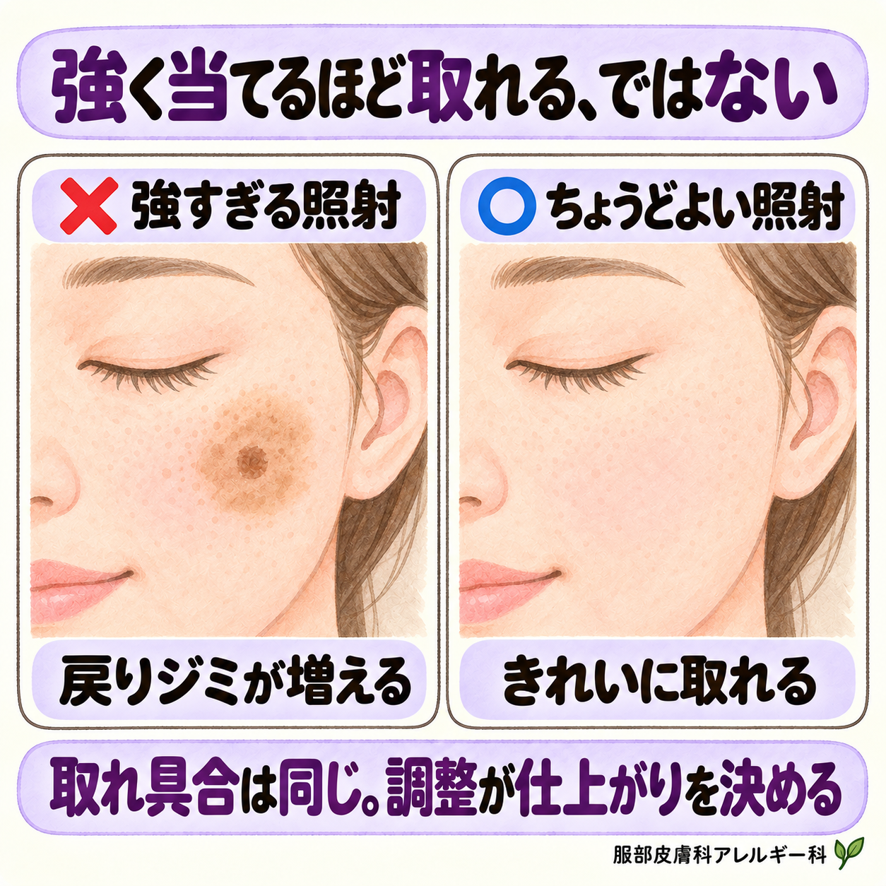強く当てるほど取れる、ではない