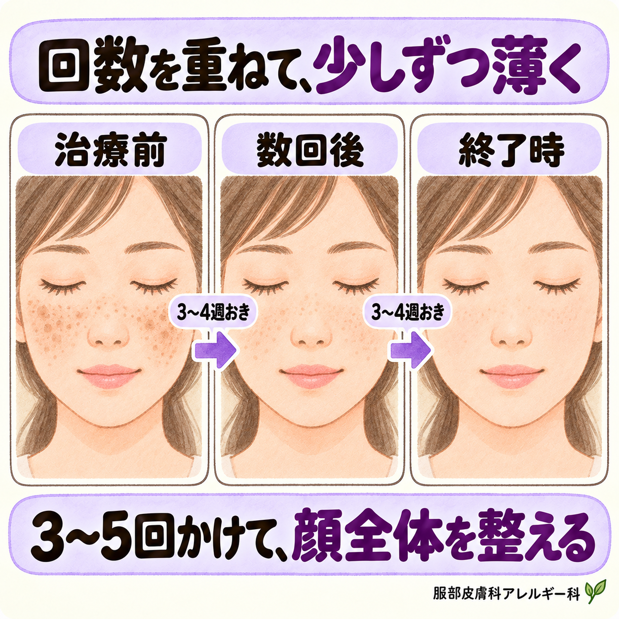 光治療は回数を重ねて少しずつ薄く