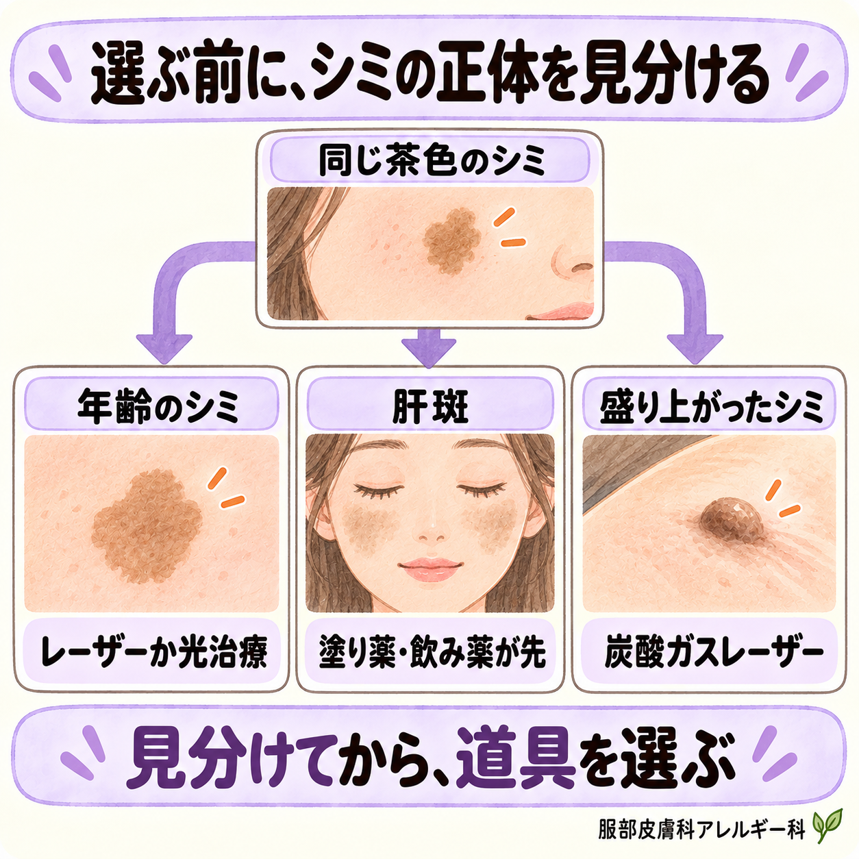 選ぶ前にシミの正体を見分ける