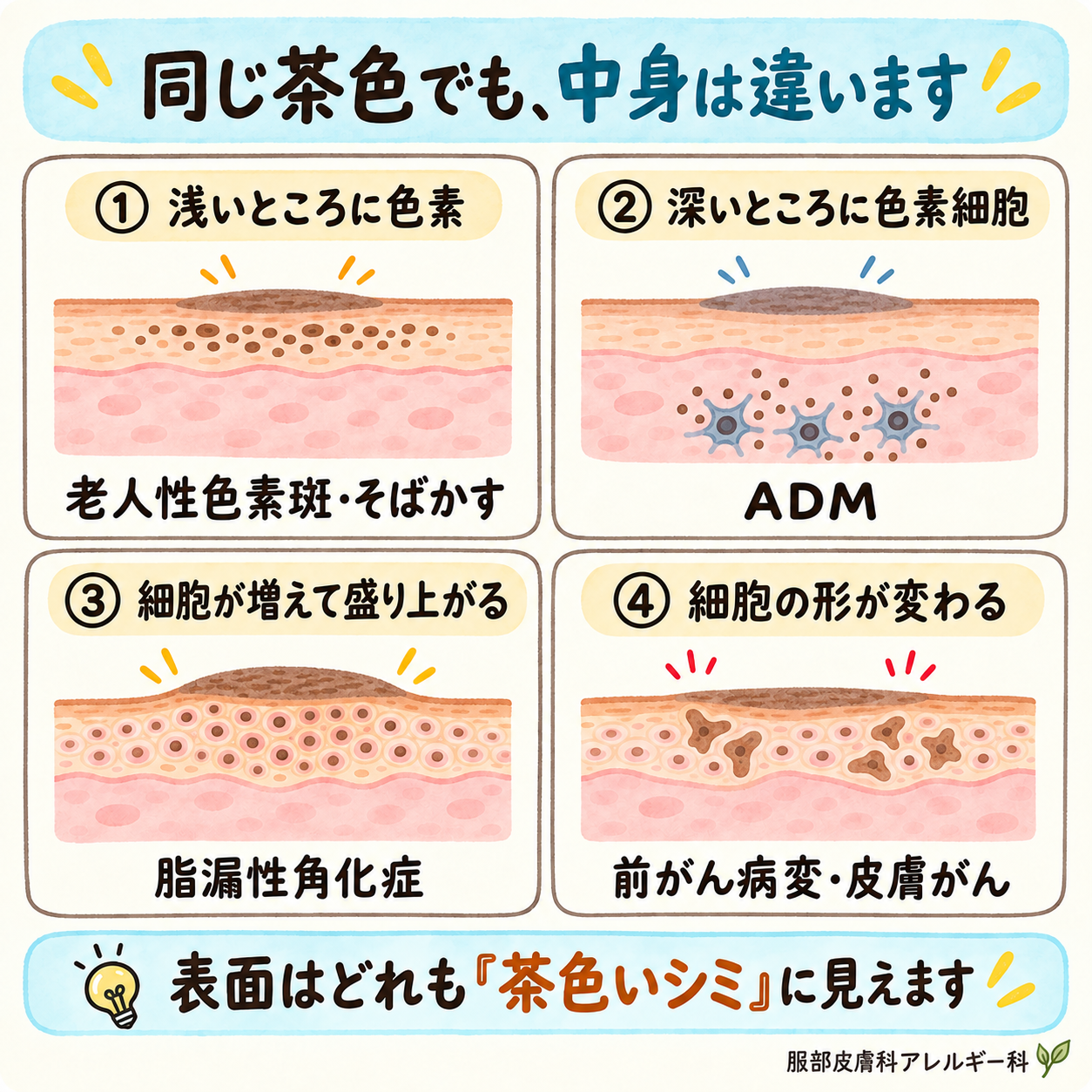 同じ茶色に見えても皮膚の中で起きていることは違う