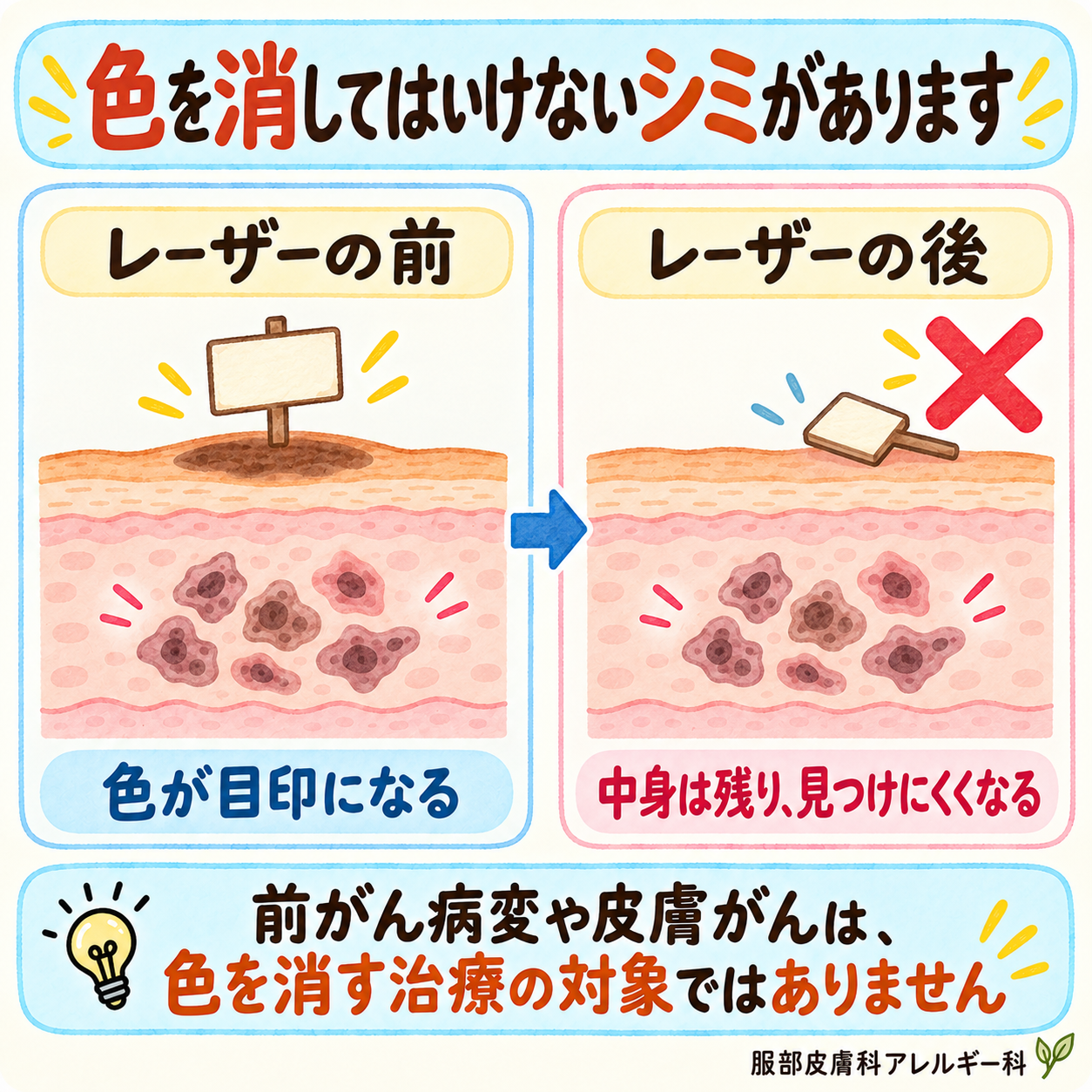 色だけ消すと病変が残り、見つけにくくなる