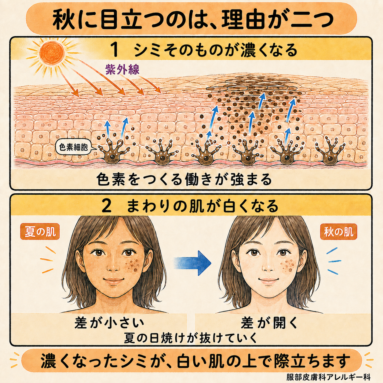 秋に目立つ理由は二つ。シミそのものが濃くなり、まわりの肌が白くなる