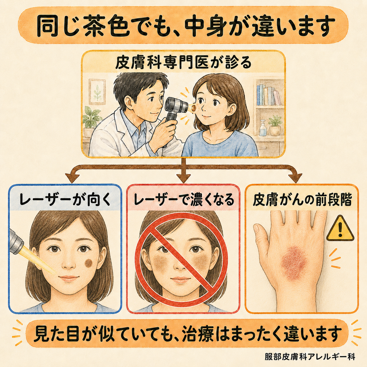 同じ茶色でも中身が違う。皮膚科専門医が診て、レーザーが向くもの、レーザーで濃くなるもの、皮膚がんの前段階を見分ける