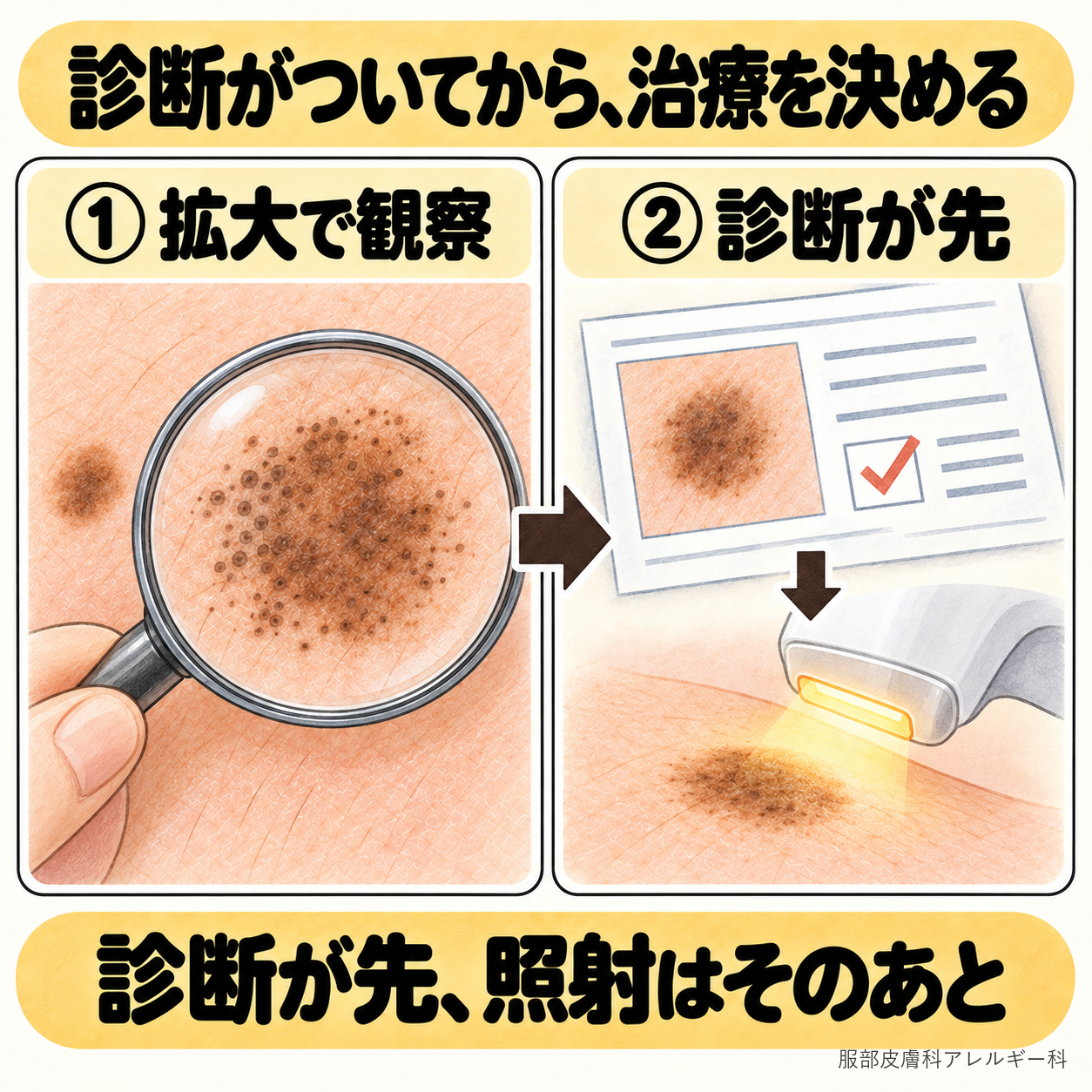 診断がついてから治療を決める